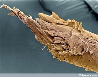 Split End of Human Hair